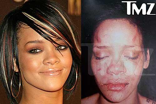 Ein Bild, das schockiert: Die von ihrem Freund Chris Brown misshandelte Rihanna.
