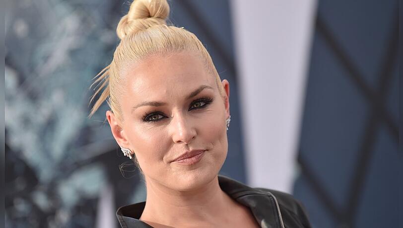 Für Lindsey Vonn spielen Hunde eine große Rolle in ihrem Leben.