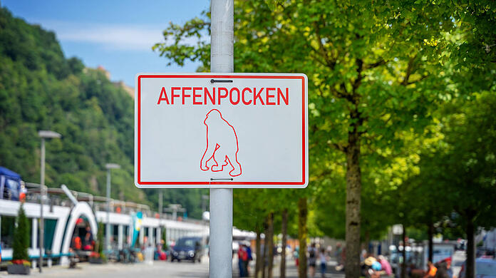 Der erste Affenpocken-Fall Deutschlands wird in München behandelt. (Symbolbild)