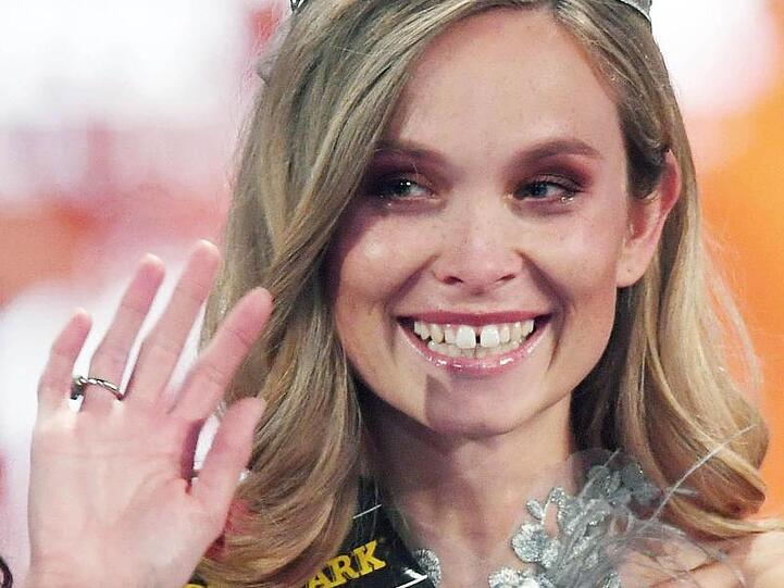 Nadine Berneis steht zu ihrer Zahnlücke.