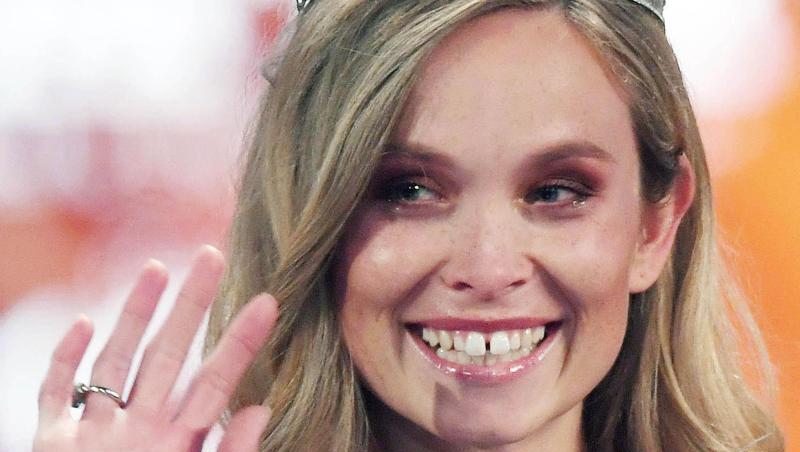 Nadine Berneis steht zu ihrer Zahnlücke. Nadine Berneis steht zu ihrer Zahnlücke.