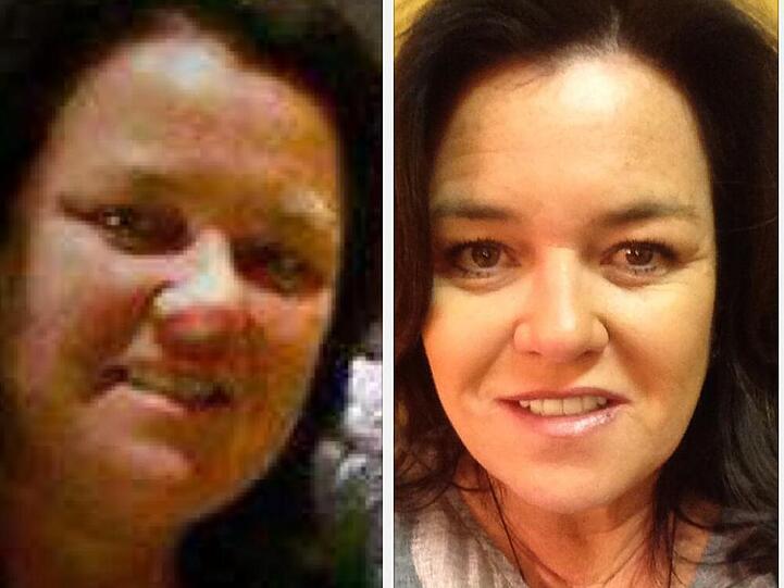 Rosie O'Donnell hat sichtlich abgenommen