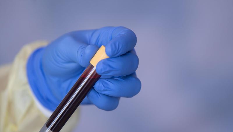 Eine Blutprobe für einen Antikörpertest beim RKI. Eine Blutprobe für einen Antikörpertest beim RKI.