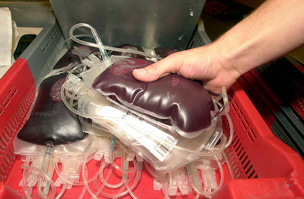 Wiederholte Bluttransfusionen können Grund für zu viel Eisen im Körper sein.