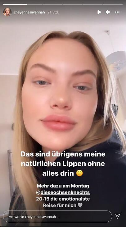 Eigenen Angaben zufolge sieht Cheyenne Ochsenknecht so ohne Lippen-Filler aus. Eigenen Angaben zufolge sieht Cheyenne Ochsenknecht so ohne Lippen-Filler aus.