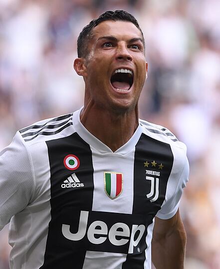 Ronaldos Zähne sind jetzt schön weiß und gerade.