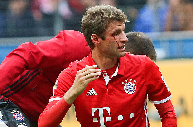 Ein Bild mit Symbolkraft: Thomas Müller erleidet eine Platzwunde im Spiel gegen Eintracht Frankfurt. Der FC Bayern scheint angeknockt.