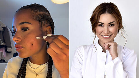 Brenda Brinkmann (li.) lie&szlig; sich Gr&uuml;bchen beim Doc modellieren. Die M&uuml;nchner Beauty-&Auml;rztin Dr. Luise Berger (re.) erkl&auml;rt solch einen Eingriff und benennt die Risiken.