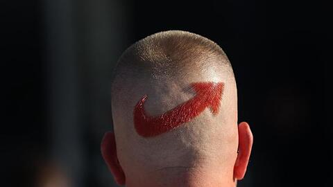 Ein AfD-Anhänger mit einem frisierten Logo der Partei auf dem Hinterkopf.
