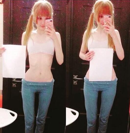 Immer mehr Mädchen zeigen auf Instagram ihre dünnen Taillen.