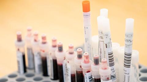 Entnommene Abstrichtests und Blutproben. Foto: Kay Nietfeld/dpa/Symbolbild