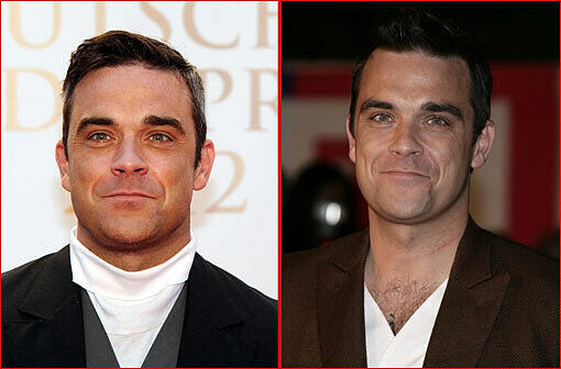Robbie Williams (38), links aktuell mit ein paar Pfunden mehr, rechts noch sichtlich schlanker im Gesicht, 2010 in Cannes.