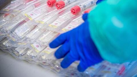 Testsets mit Abstrichstäbchen liegen in einem Testzentrum für Corona-Verdachtsfälle. Foto: Jens Büttner/dpa-Zentralbild/dpa/Symbolbild