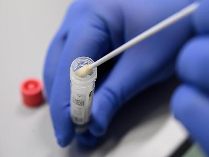 Ein Mann zeigt einen Abstrich für das Testverfahren auf das Virus SARS-CoV-2. Foto: Sebastian Gollnow/dpa/Symbolbild