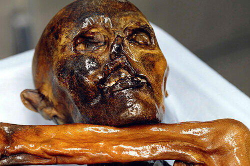 Ötzi ist in der Archäologischen Staatssammlung per Webcam live zu sehen.