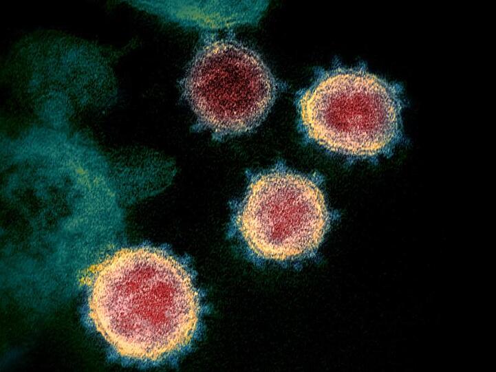 Eine elektronenmikroskopische Aufnahme zeigt das Virus, das Covid-19 verursacht. Foto: -/NIAID-RML/via AP/dpa/Archivbild