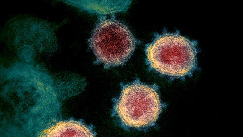 Eine elektronenmikroskopische Aufnahme zeigt das Virus, das Covid-19 verursacht. Foto: -/NIAID-RML/via AP/dpa/Archivbild Eine elektronenmikroskopische Aufnahme zeigt das Virus, das Covid-19 verursacht. Foto: -/NIAID-RML/via AP/dpa/Archivbild