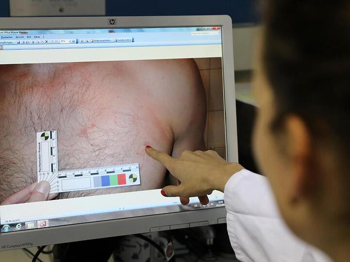 Im Untersuchungsraum der Opferambulanz am Institut für Rechtsmedizin zeigt eine Assistenzärztin den dokumentierten Fall einer Verletzung bei einem Mann.