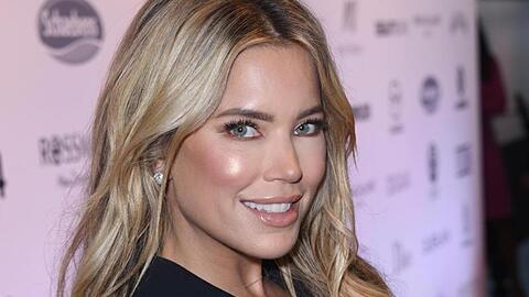 Die niederländische Moderatorin Sylvie Meis hat zugegeben, dass sie für ein faltenfreies Gesicht nachhelfen lässt. (Archivbild)