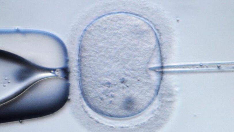 Mikroskopische Aufnahme einer menschlichen Eizelle, die in einem Speziallabor injiziert wird. Eine niederländische Klinik hat möglicherweise durch einen "Verfahrensfehler" Frauen mit falschem Sperma befruchtet.