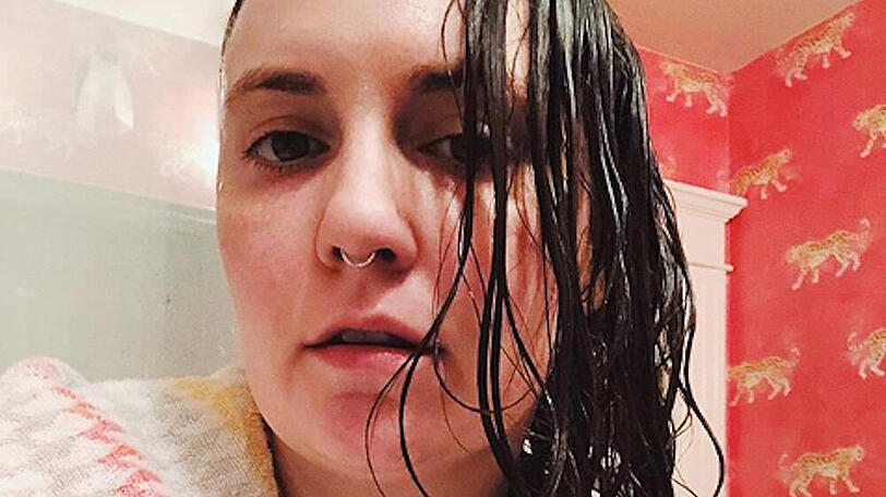 Lena Dunham spricht offen über ihre Probleme