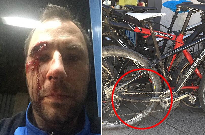 Rainer Nachtwey nach dem Unfall. Sein Simplon-Bike (schwarz) ist nach dem Unfall schrottreif.