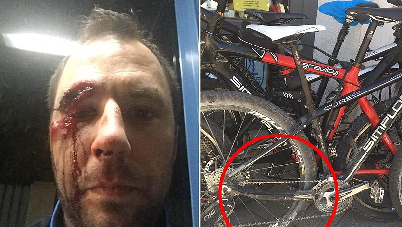 Rainer Nachtwey nach dem Unfall. Sein Simplon-Bike (schwarz) ist nach dem Unfall schrottreif. Rainer Nachtwey nach dem Unfall. Sein Simplon-Bike (schwarz) ist nach dem Unfall schrottreif.