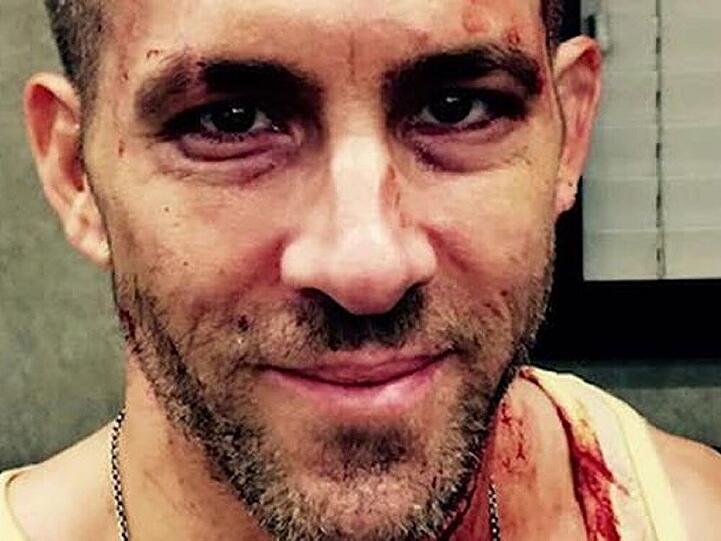 Ryan Reynolds hat beim "Deadpool"-Dreh eine Ladung Kunstblut abbekommen