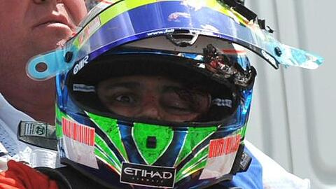 Felipe Massa, direkt nach dem Unfall. Ohne den Helm hätte die umherfleigende Schraubenfeder Massa wohl getötet.