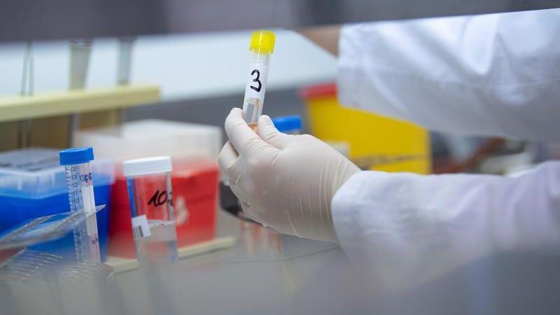Eine Ärztin zeigt in einem Labor einen Test für das Coronavirus. Foto: Sebastian Gollnow/dpa/Symbolbild