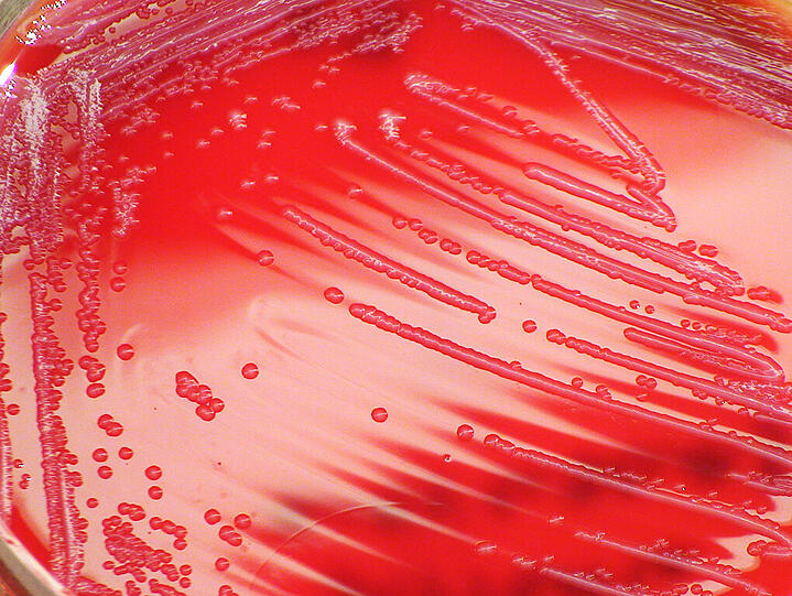 Der Keim Serratia marcescens ist in der Berliner Klinik Charité bei fünf Neugeborenen nachgewiesen worden. Foto: Pete Seidel/CDC/Archiv