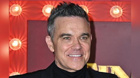 Robbie Williams lie&szlig; sich vor zwei Jahren Veneers einsetzen.
