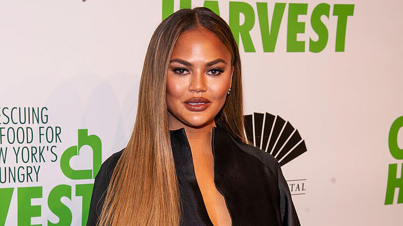 Chrissy Teigen leidet in ihrer Schwangerschaft an starken Kopfschmerzen.