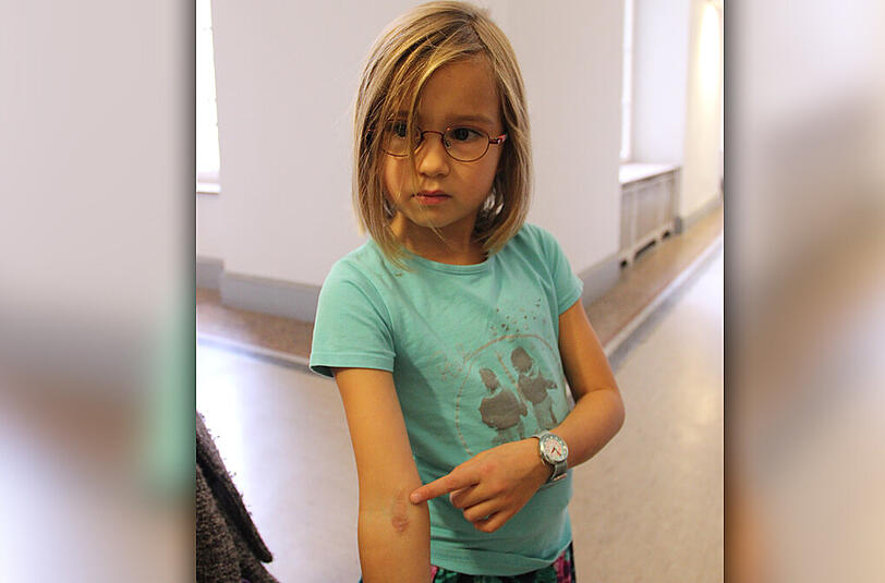 Sophia zeigt ihre Narbe.