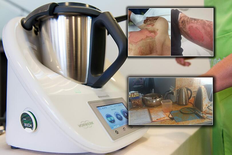 Der Thermomix der Frau explodierte, sie erlitt Verletzungen am Oberkörper und an den Armen.