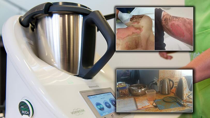 Der Thermomix der Frau explodierte, sie erlitt Verletzungen am Oberkörper und an den Armen. Der Thermomix der Frau explodierte, sie erlitt Verletzungen am Oberkörper und an den Armen.
