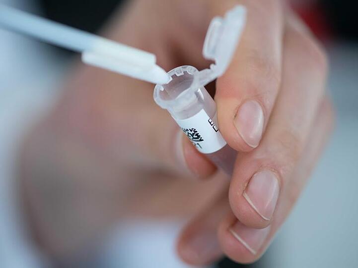 Menschliche Zellen für eine DNA-Probe werden in ein Reaktionsgefäß überführt. (Symbolbild)