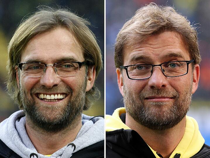 Mit seinen multiplen OPs spielt Glööckler definitiv in einer höheren Liga als Jürgen Klopp (45), der im April 2013 zugab, dass große Teile seiner Frisur einem Schönheits-Chirurgen zu verdanken sind. Der Trainer von Borussia Dortmund hatte sich einer Haartransplantation unterzogen als die Geheimratsecken gar zu schlimm wurden. Sein Kommentar: "Ich finde, das Ergebnis ist ganz cool geworden, oder?"