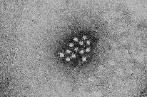 Der Hepatitis-Virus wird durch &bdquo;Schmierinfektion&ldquo; übertragen.