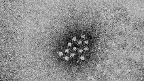 Der Hepatitis-Virus wird durch „Schmierinfektion“ übertragen. Der Hepatitis-Virus wird durch „Schmierinfektion“ übertragen.