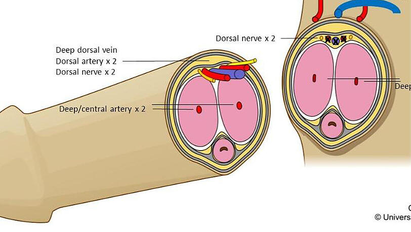 Einem Ärzteteam der Universität Stellenbosch und dem Tygerberg Academic Hospital gelang es kürzlich, einen Penis zu transplantieren (grafische Darstellung). Einem Ärzteteam der Universität Stellenbosch und dem Tygerberg Academic Hospital gelang es kürzlich, einen Penis zu transplantieren (grafische Darstellung).