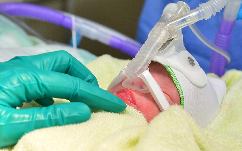 Eine aus Albanien geflohene Frau Vierlinge hat an der Uni-Klinik Jena Vierlinge zur Welt gebracht.