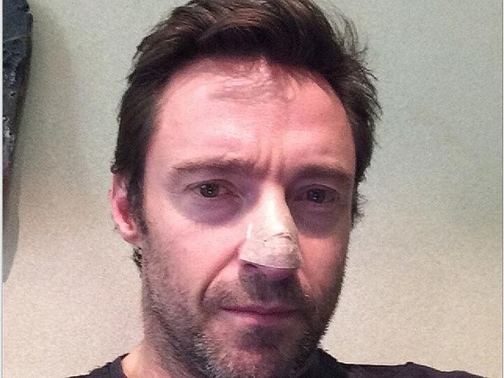 Dieses Bild postete Schauspieler Hugh Jackman nach dem Eingriff