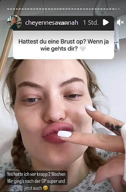 Cheyenne Ochsenknecht wenige Stunden nach ihrer Brust-OP Cheyenne Ochsenknecht wenige Stunden nach ihrer Brust-OP