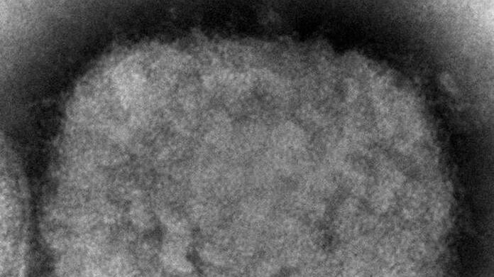 Vernunft statt Angst: Die Aidshilfe spricht sich im Umgang mit Affenpocken gegen Stigmatisierung aus.