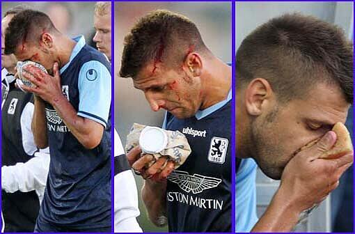 Beim 0:0 im Test gegen Austria muss Guillermo Vallori mit viel Blut am Kopf vom Feld. Die Löwen-Fans befürchten schnell schlimmstes &ndash; Trainer Maurer aber bleibt gelassen. Sehen Sie hier die Bilder.