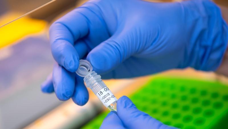Eine Mitarbeiterin im DNA-Labor des Bayerischen LKA bereitet eine DNA-Probe für die Analyse vor. Foto: Sven Hoppe/dpa Eine Mitarbeiterin im DNA-Labor des Bayerischen LKA bereitet eine DNA-Probe für die Analyse vor. Foto: Sven Hoppe/dpa