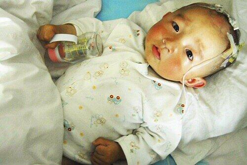 Bekommen von der verseuchten Milch Nierenbeschwerden: Baby in China