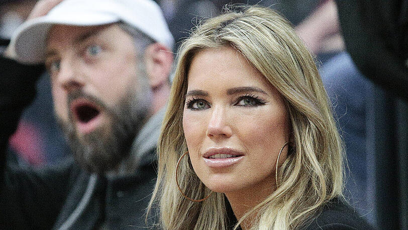 Das Gesicht von Sylvie Meis sieht im Vergleich zu früher ganz anders aus.