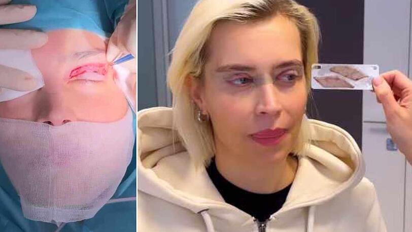 Für ihr Aussehen hat sich Verena Kerth beim Beauty-Doc unters Messer gelegt. Für ihr Aussehen hat sich Verena Kerth beim Beauty-Doc unters Messer gelegt.